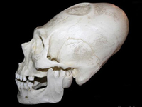 Вытянутый череп (Перу)
