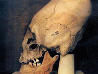 Перуанский вытянутый череп