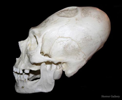 Вытянутый череп (Перу)