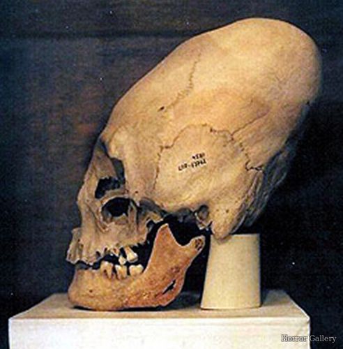 Перуанский вытянутый череп