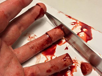 Отрубленные ножом пальцы руки