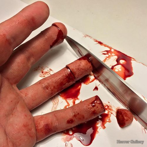 Отрубленные ножом пальцы руки