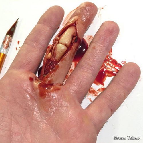 Палец руки разрезанный до кости